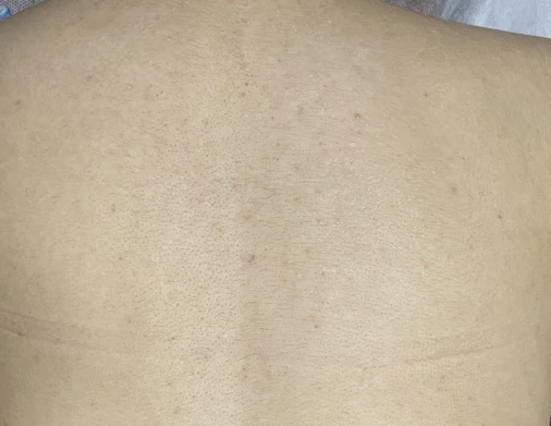 before_image