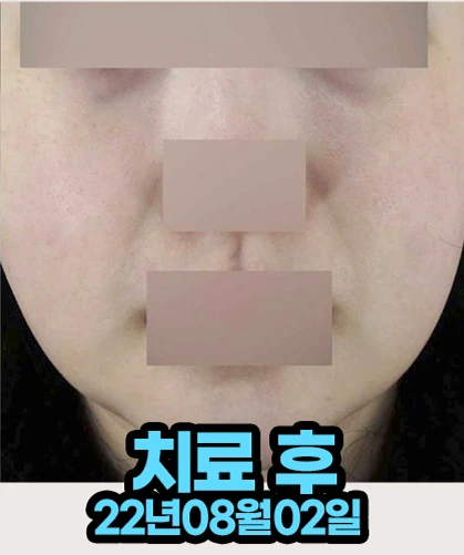 before_image