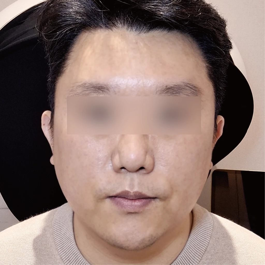 before_image