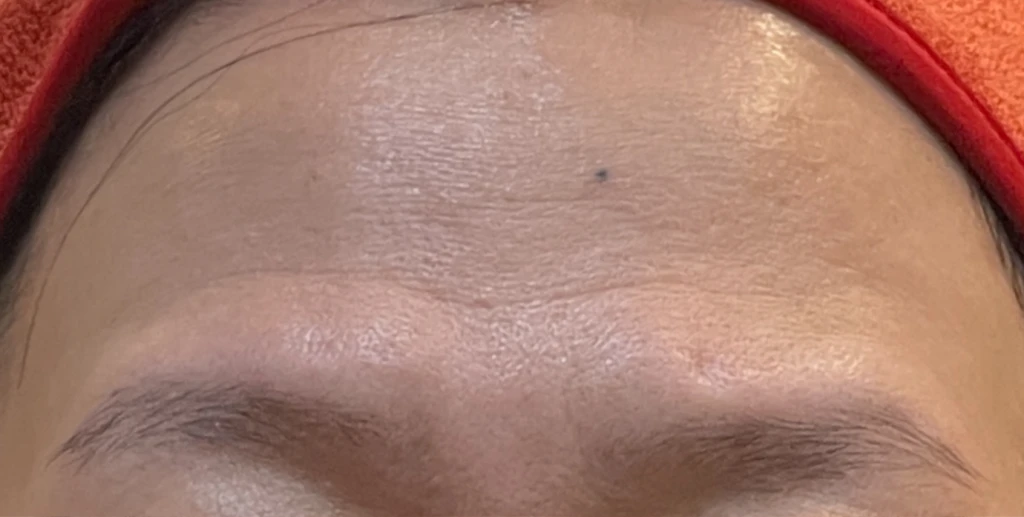 before_image