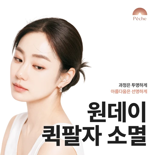 treatment-event-thumbnail