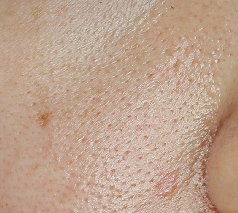 before_image