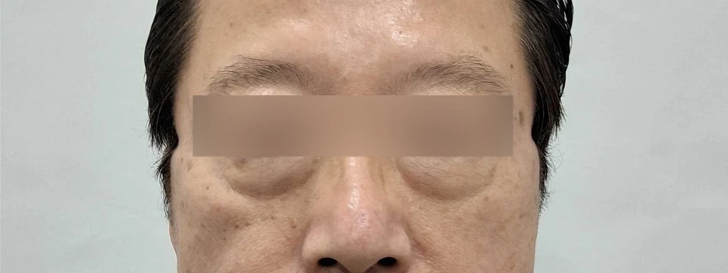 before_image
