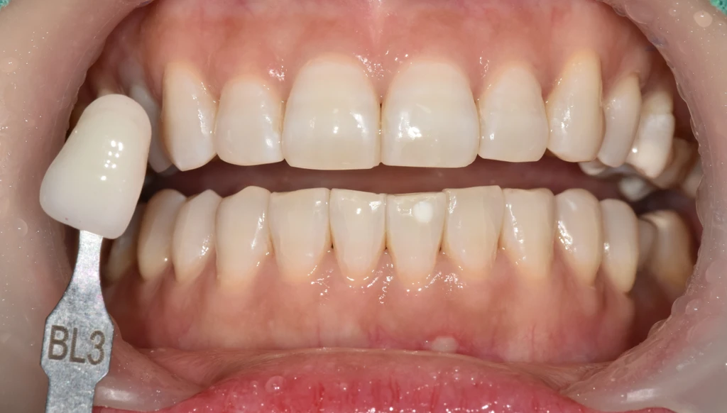 before_image