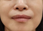 before_image