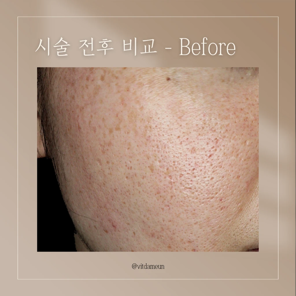 before_image