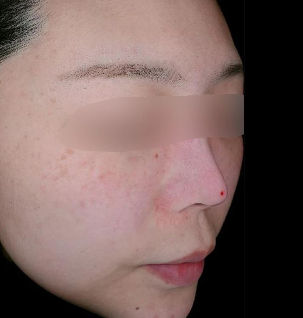 before_image