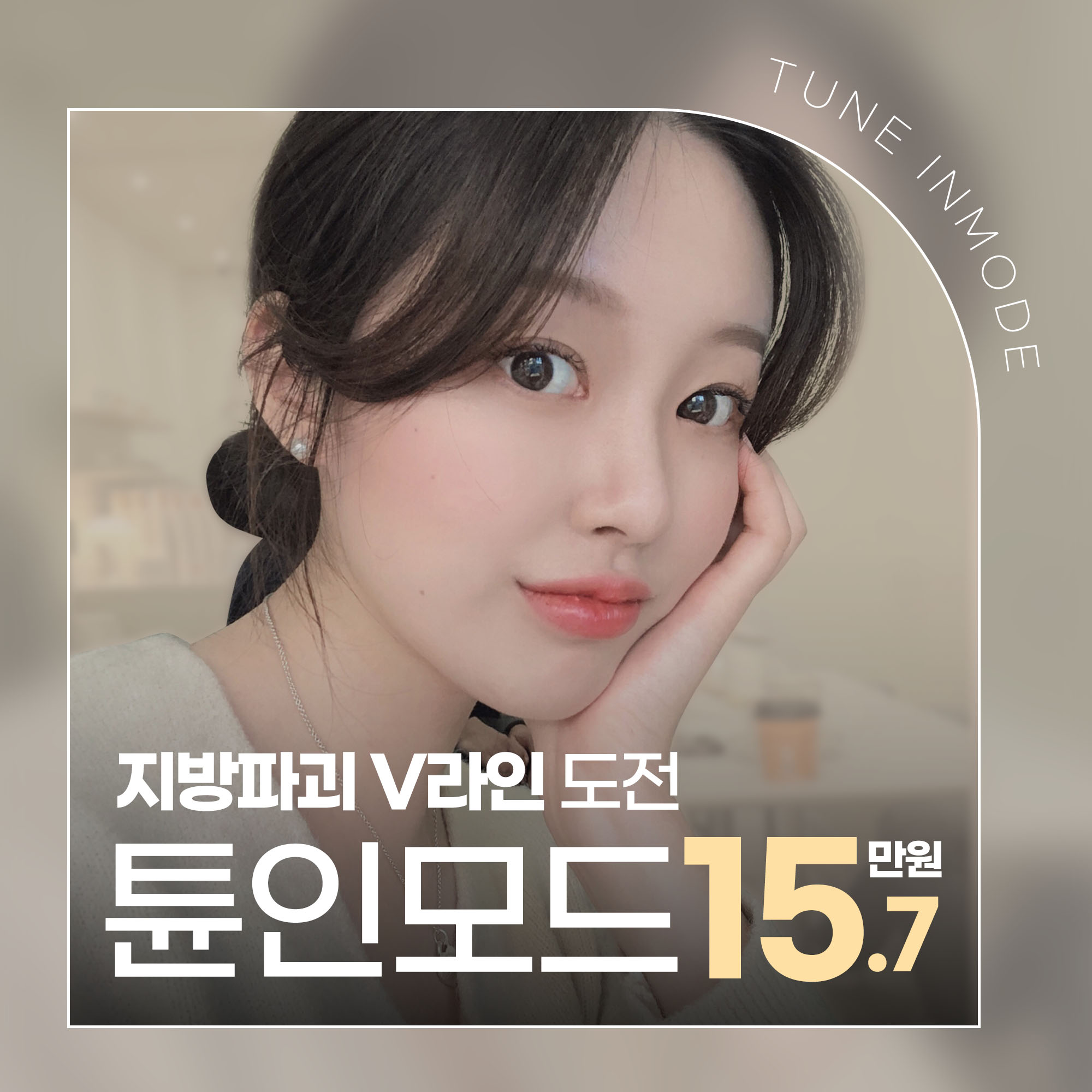 treatment-event-thumbnail
