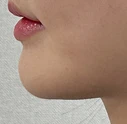 before_image