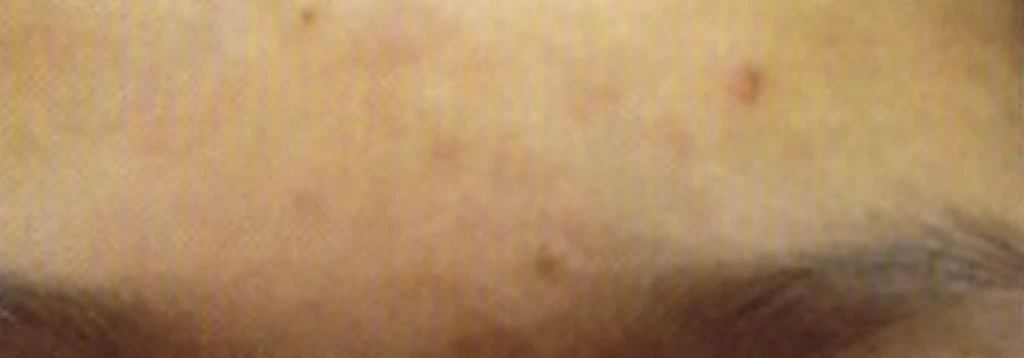 before_image