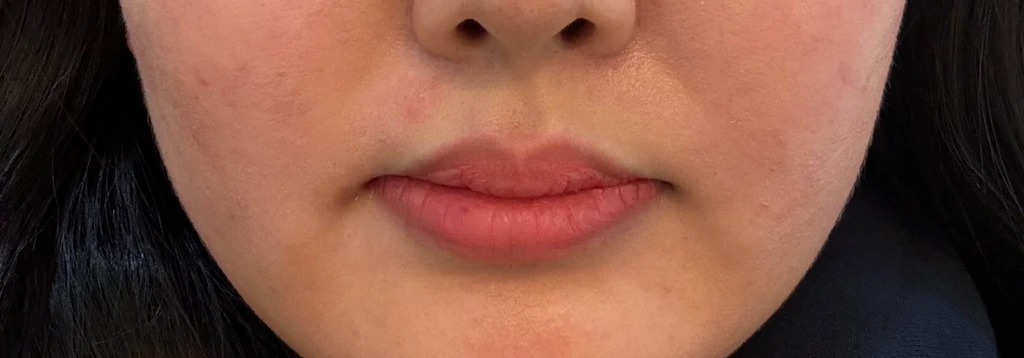 before_image