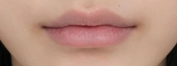 before_image
