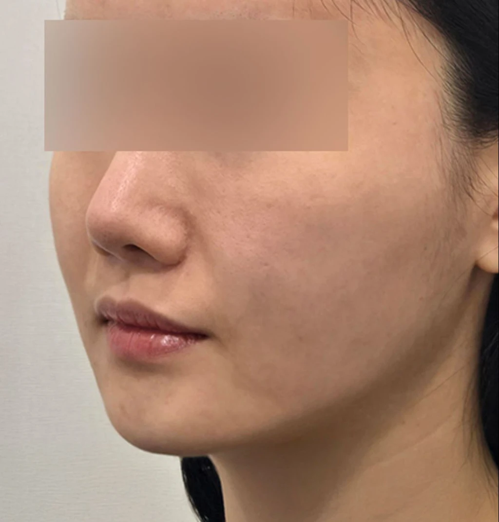 before_image