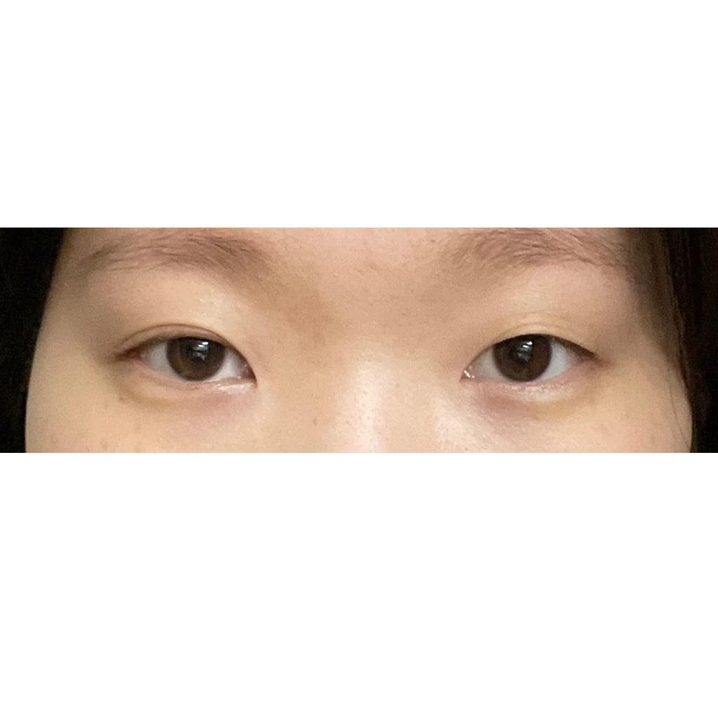before_image