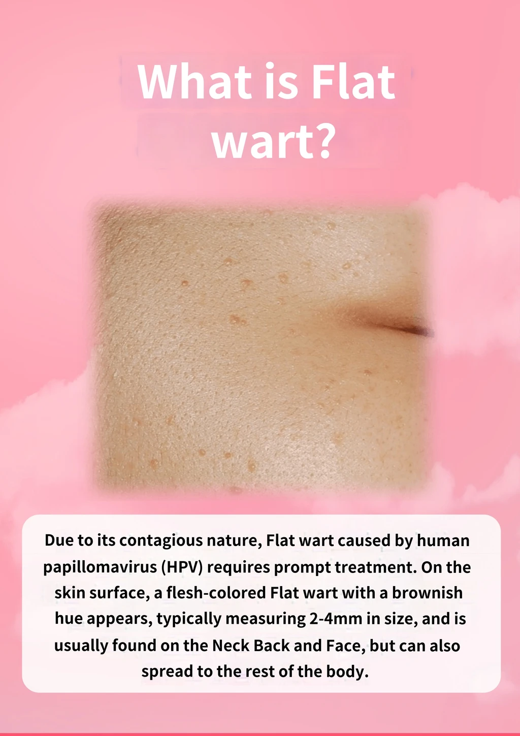 treatmentIntroduction