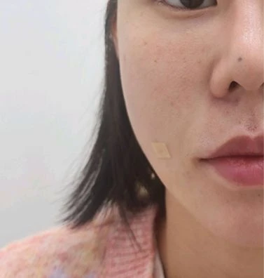 before_image