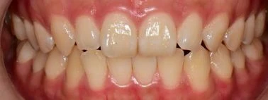 before_image