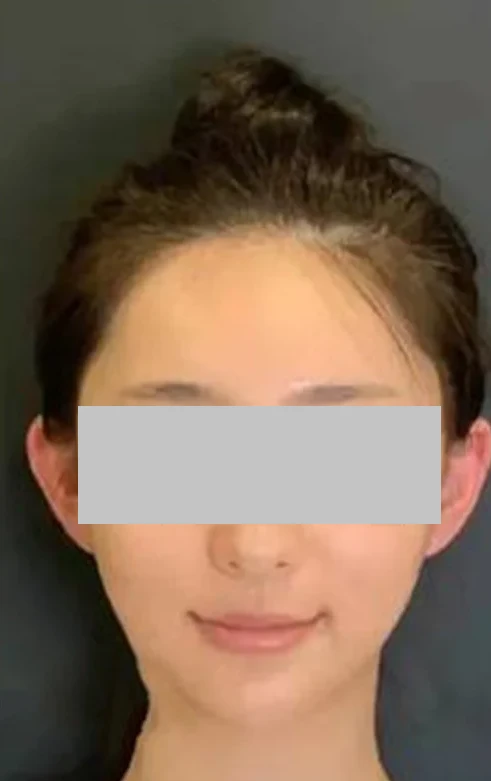 before_image