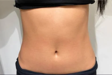 before_image