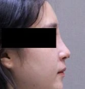 before_image