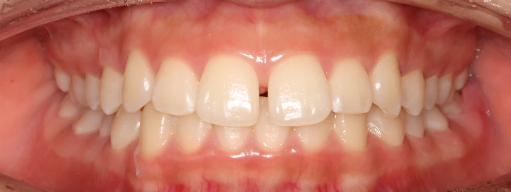 before_image
