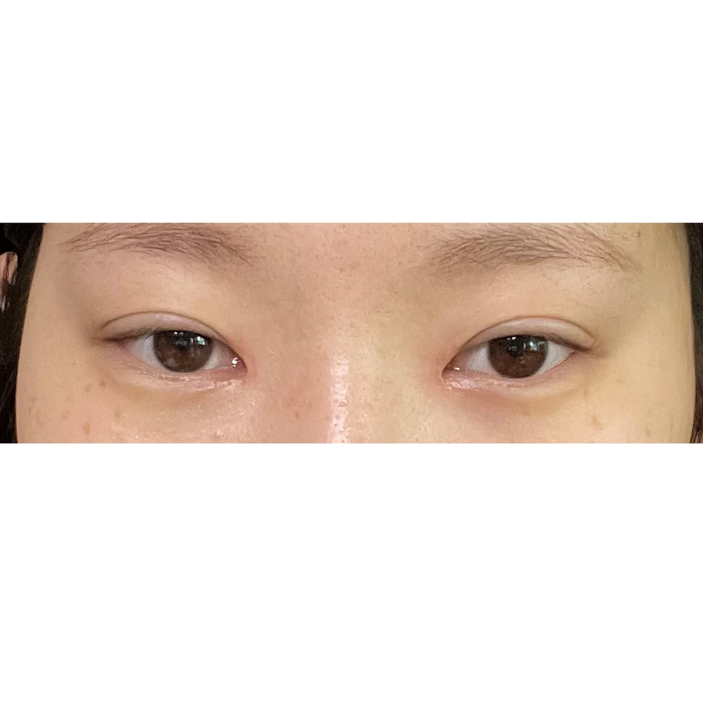 before_image