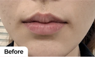before_image