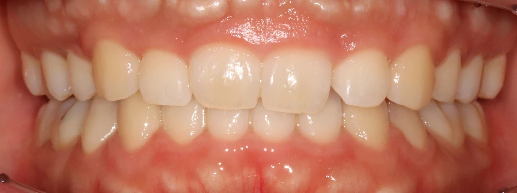 before_image