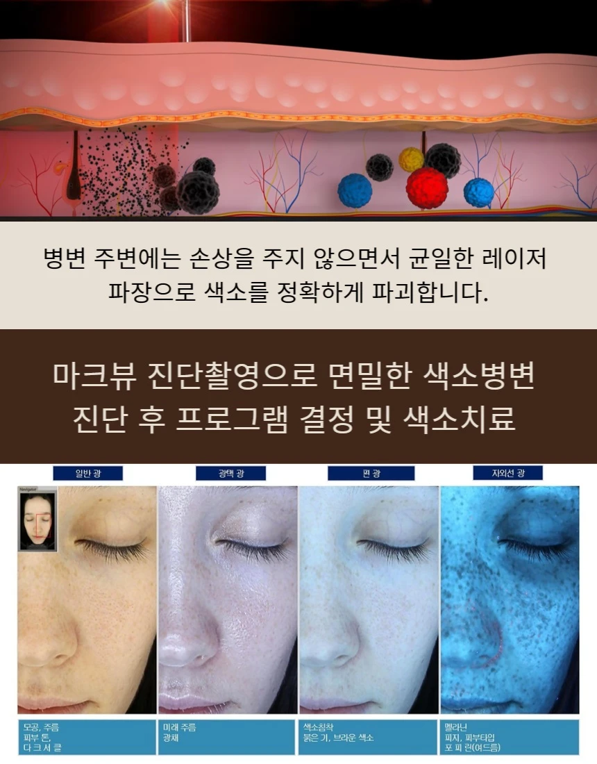 treatmentIntroduction