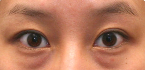 before_image