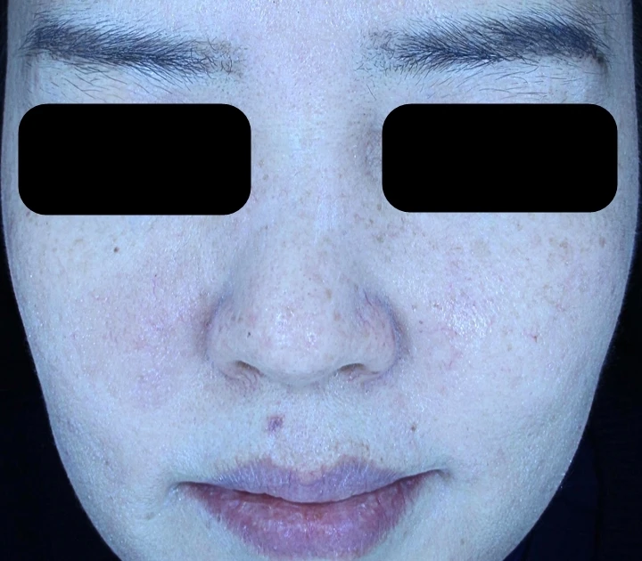 before_image