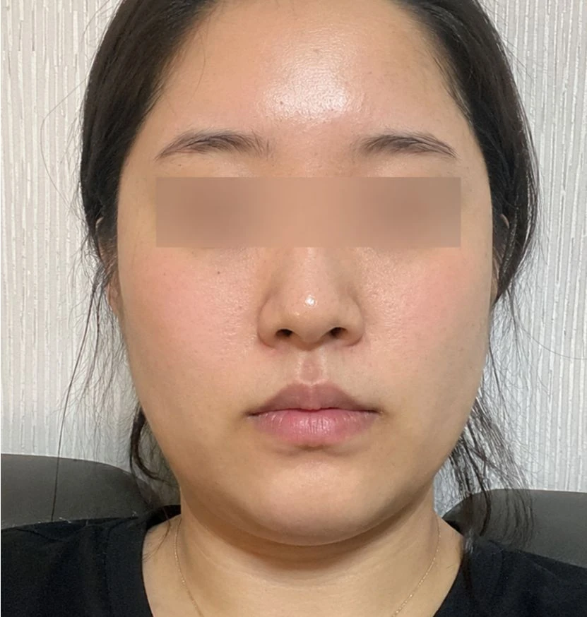 before_image