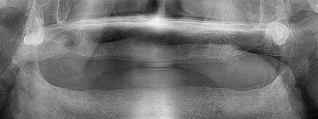 before_image