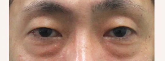 before_image