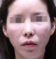 before_image