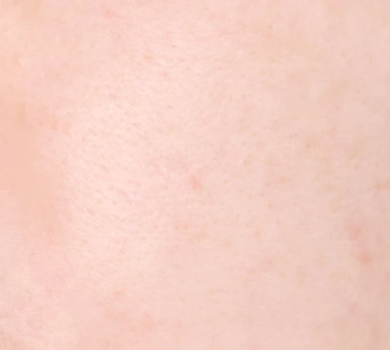 before_image