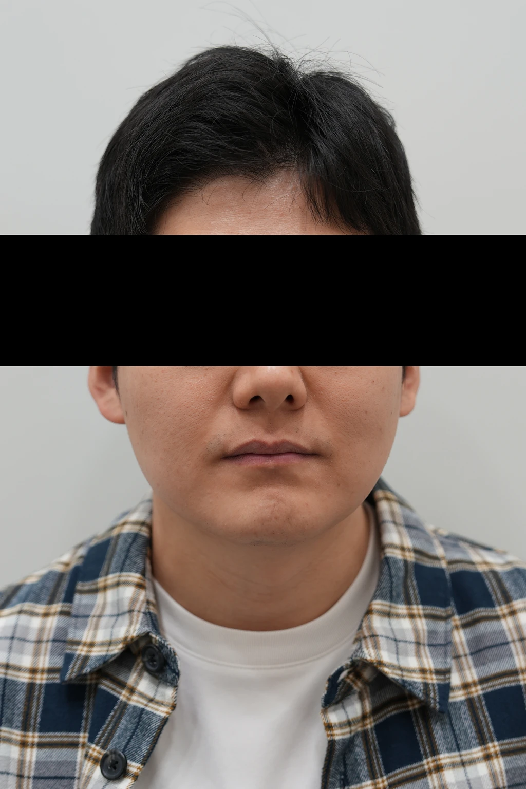 before_image