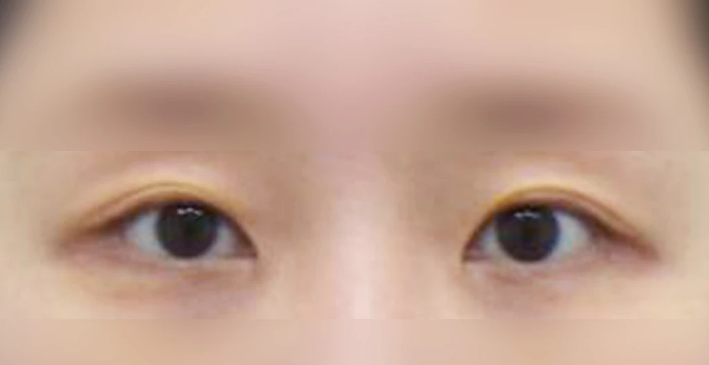 before_image