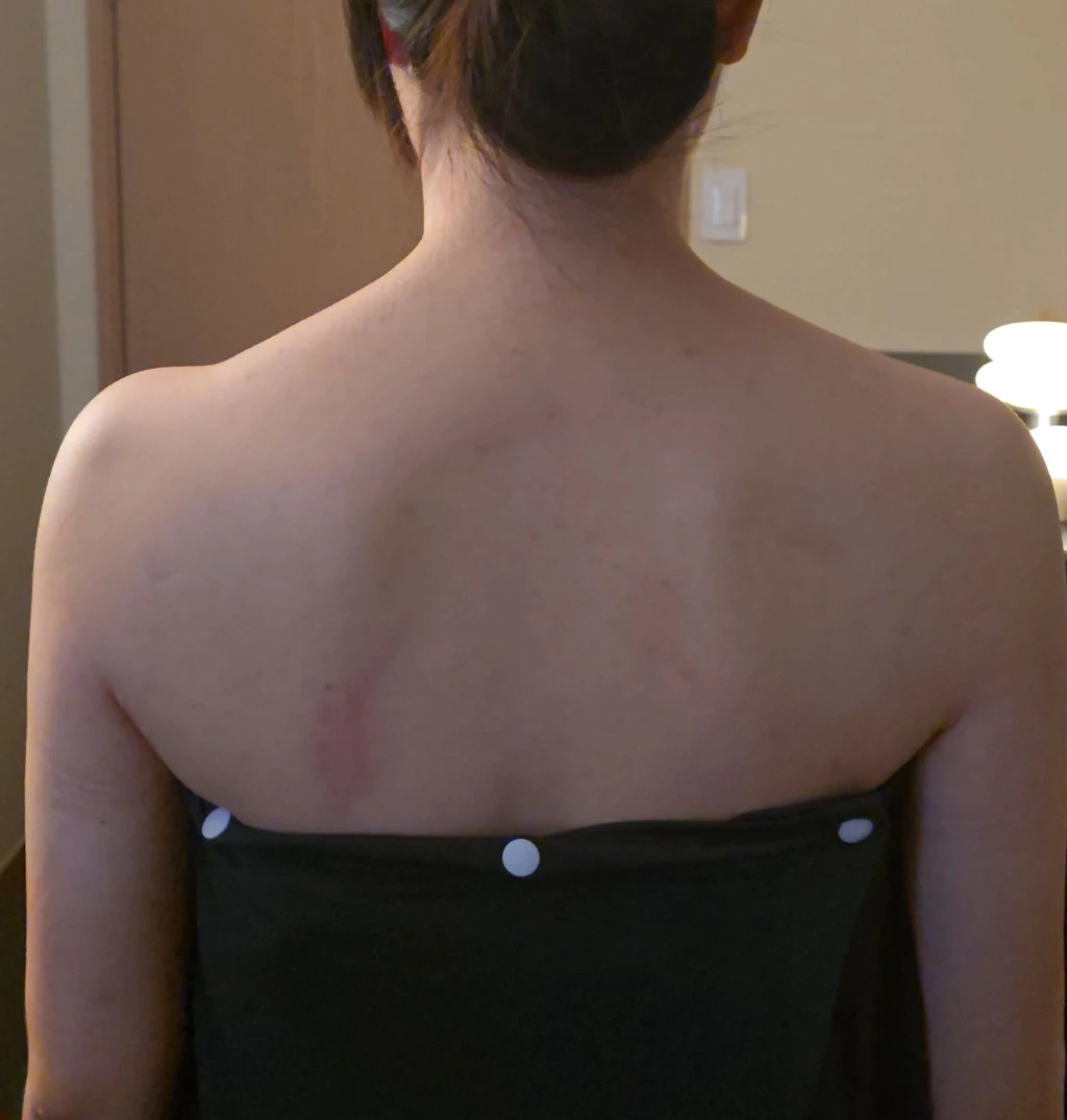before_image