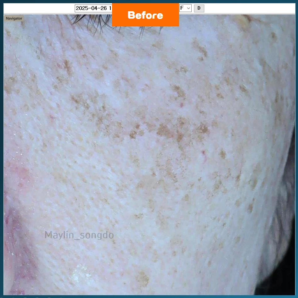 before_image