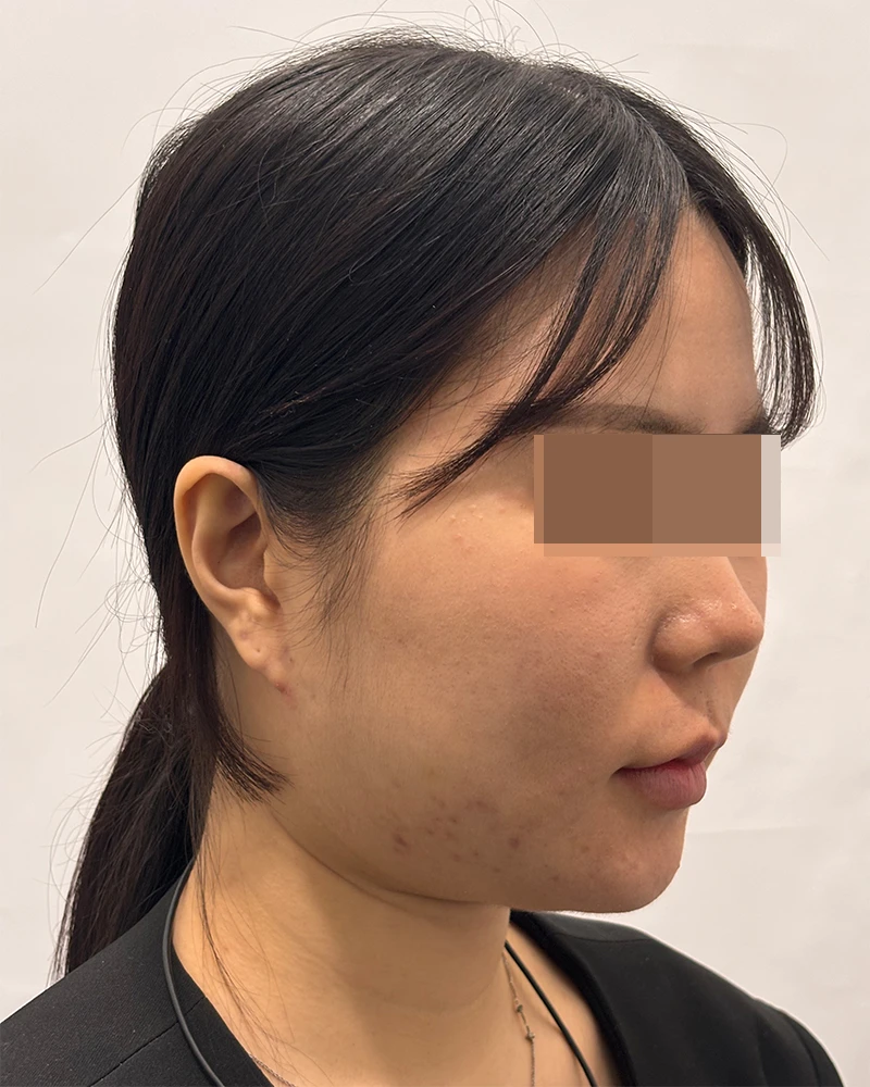 before_image