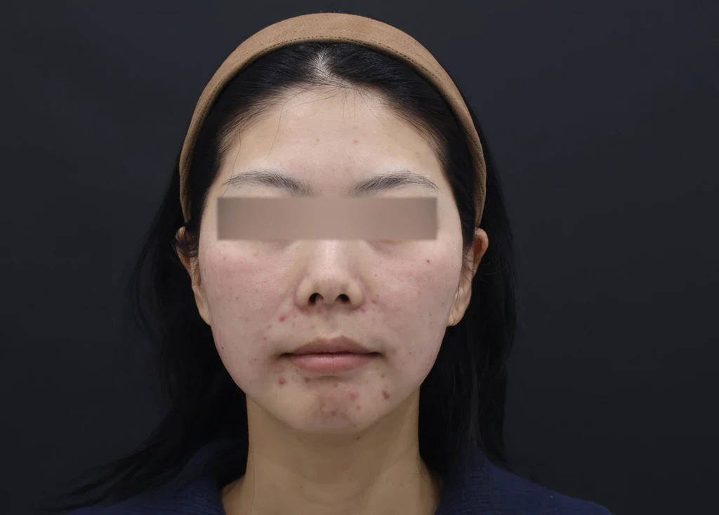 before_image
