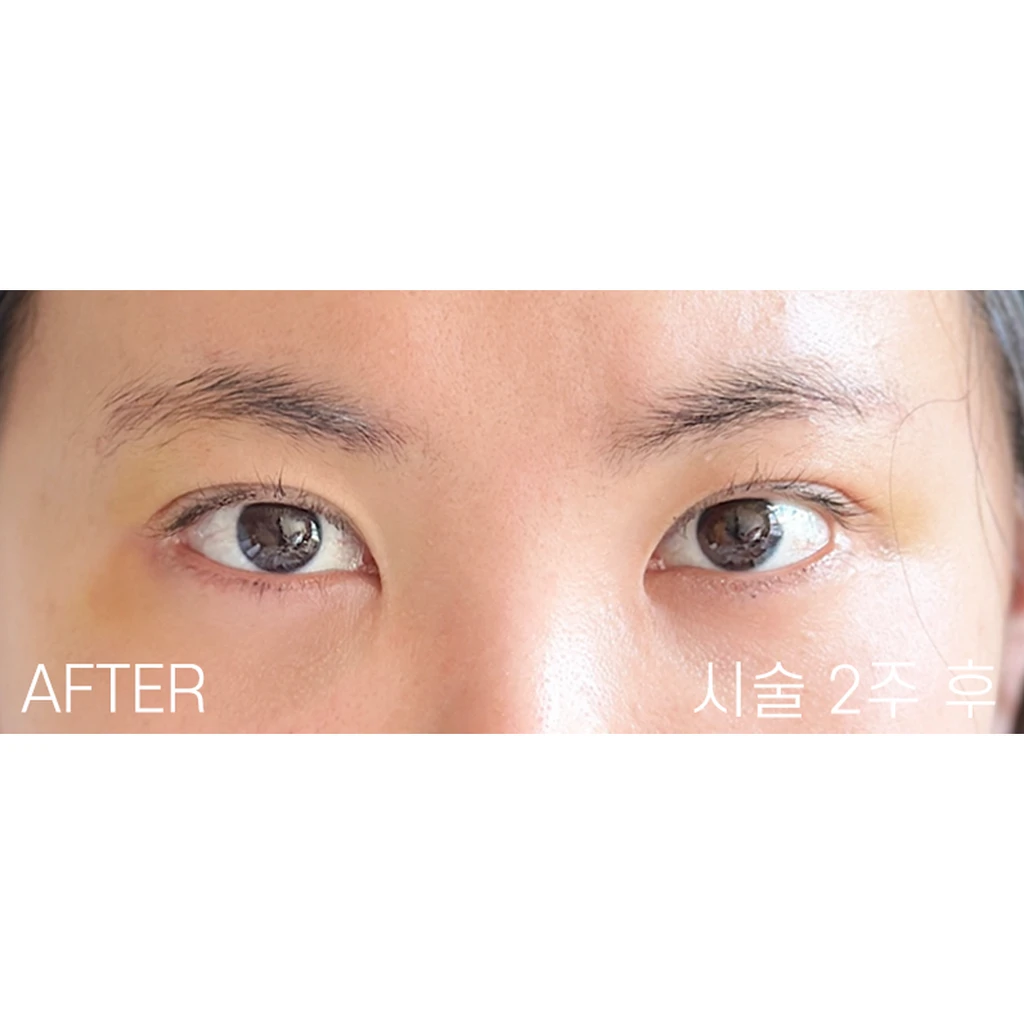 before_image