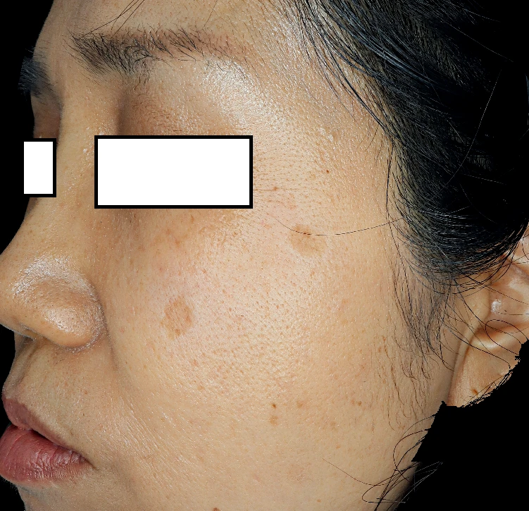 before_image