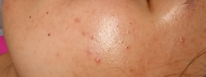before_image