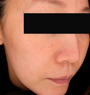 before_image