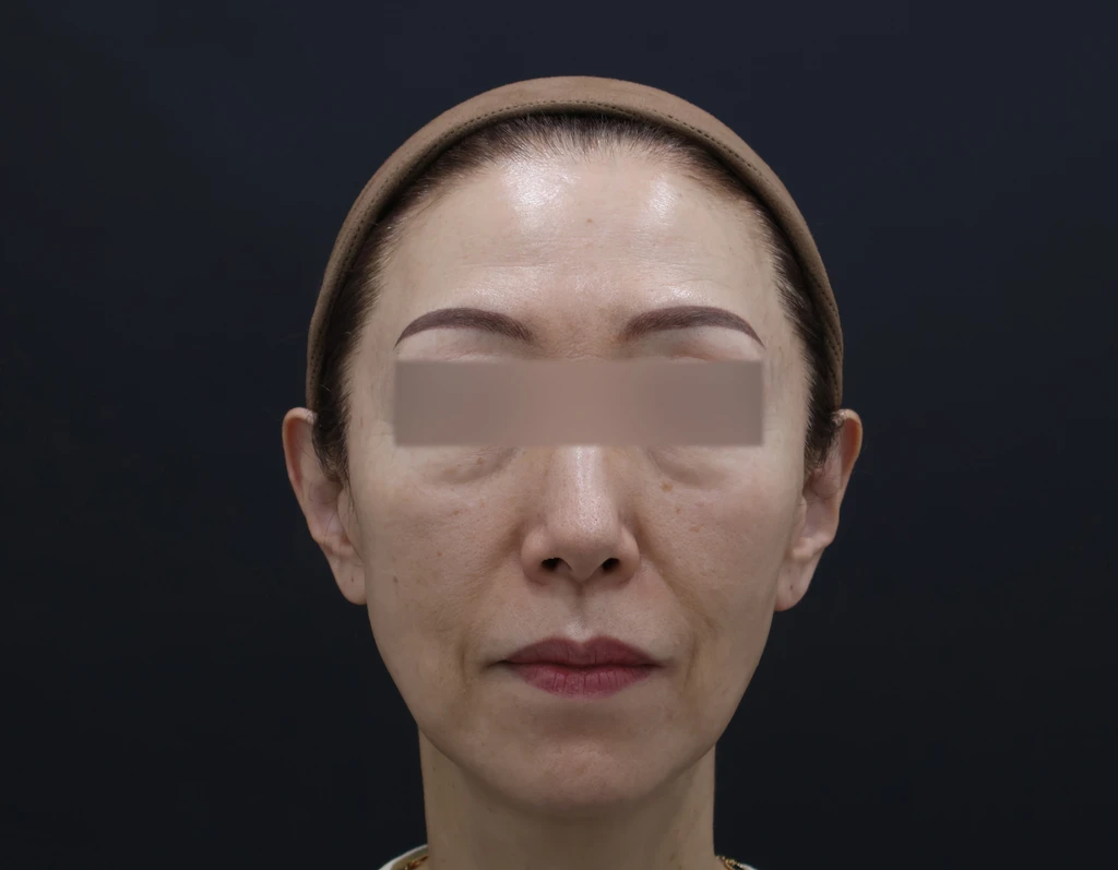 before_image