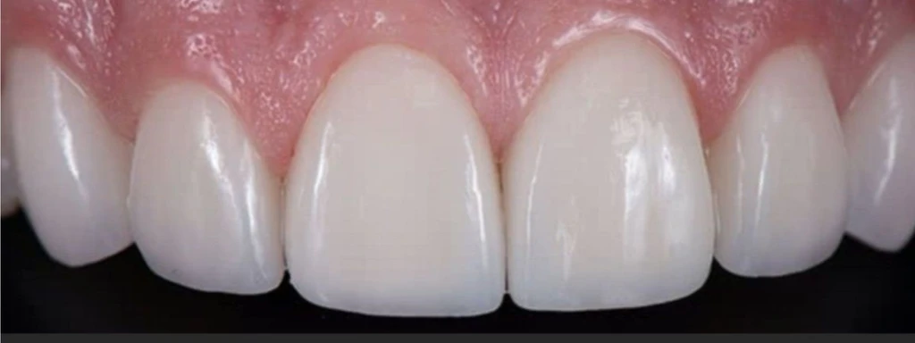 before_image