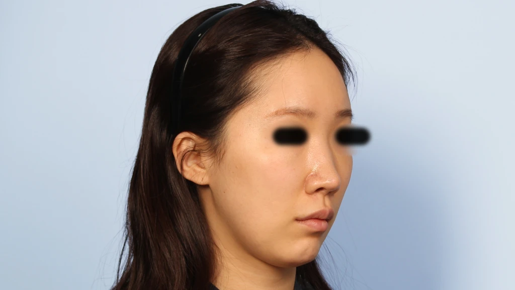 before_image