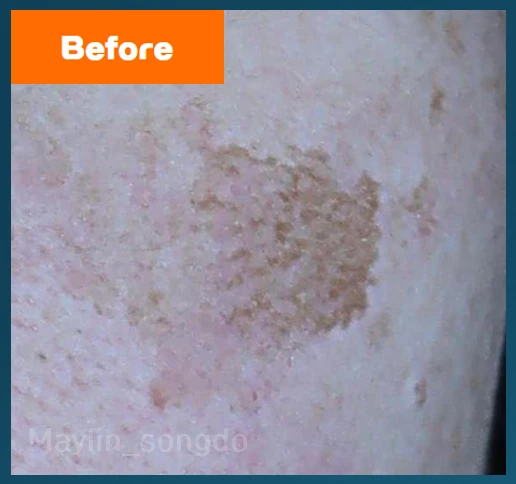 before_image